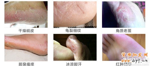 41.【亮鉆計劃】拒絕理由解析&mdash;&mdash;涉及色情丑陋的解決方案